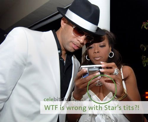 Close up picture of Star and Al looking at a camera with Star's saggy cleavage circled and the caption WTF is wrong with Star's tits?