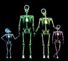 X-ray scan of a family