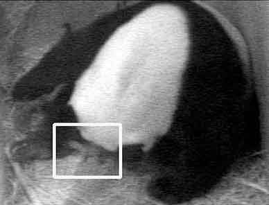 Mei Xiang and her newborn panda cub