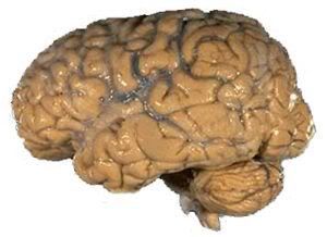 300px-Human_brain_NIH.jpg