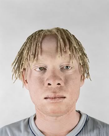 african_american_albinos_9.jpg