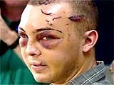 160_beating_victim6_20040803.jpg