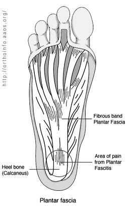 Pain In Arch