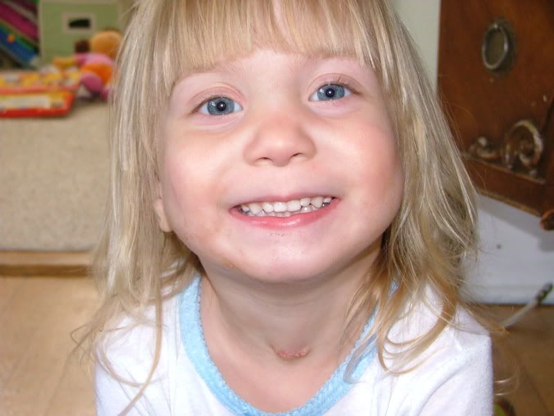 jual power figure ranger action Message Aaron's stoma pics   Kate's Tracheostomy Board