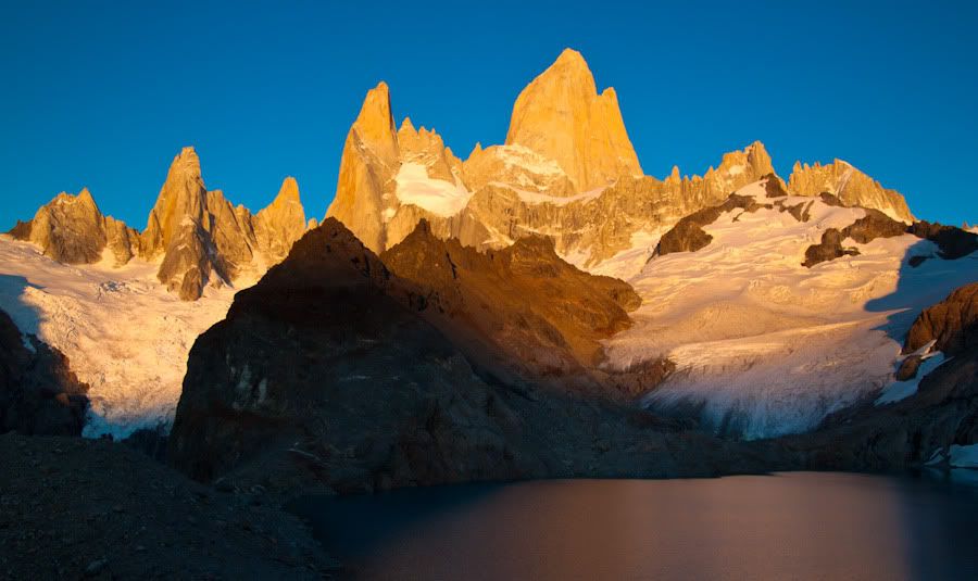 IMAGE: http://img.photobucket.com/albums/v129/soybomb/IMG_4731-2.jpg