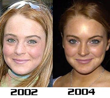 lindsay_lohan_nose1.jpg