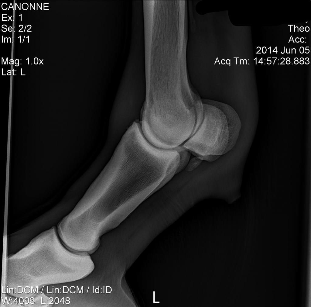 Bone chip / spurring in fetlock; lame forever?! The Horse Forum