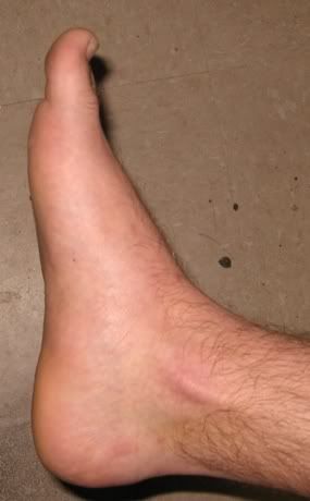 foot.jpg