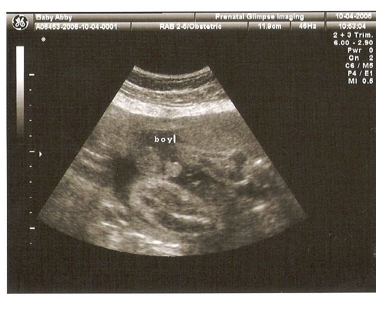 female gender ultrasound