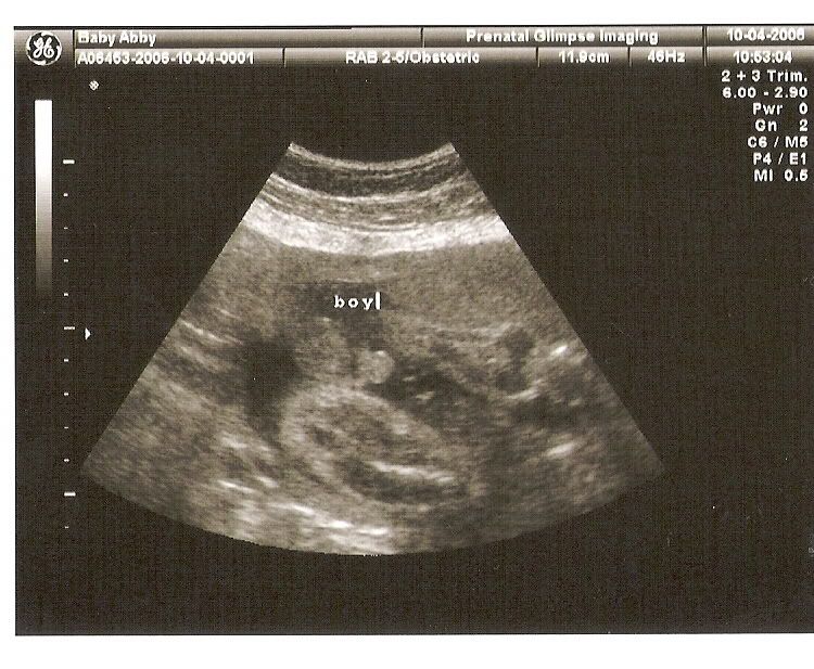 Does Chinese Pregnancy Gender Calendar Work : Why Take An Ultrasound Image Of Your Baby 