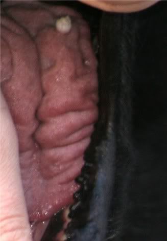 Tongue Warts Pictures