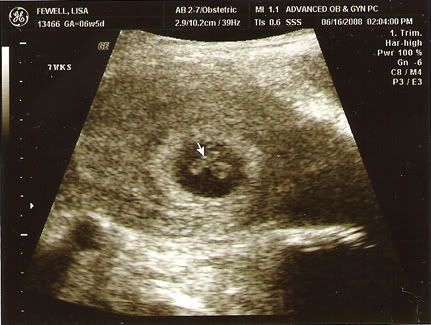 ultrasound.jpg