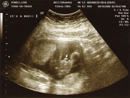 ultrasound1.jpg