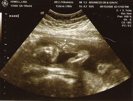 ultrasound2.jpg