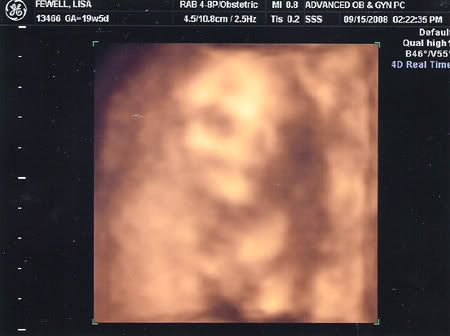 ultrasound4.jpg