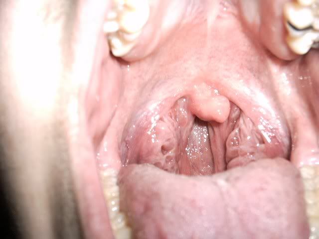 http://img.photobucket.com/albums/v187/shalerpunk/puke.jpg