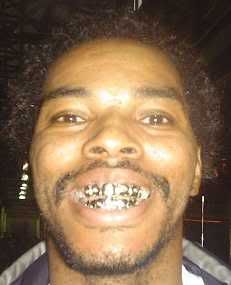 <img:http://img.photobucket.com/albums/v194/Ravendark666/goldteeth.jpg>