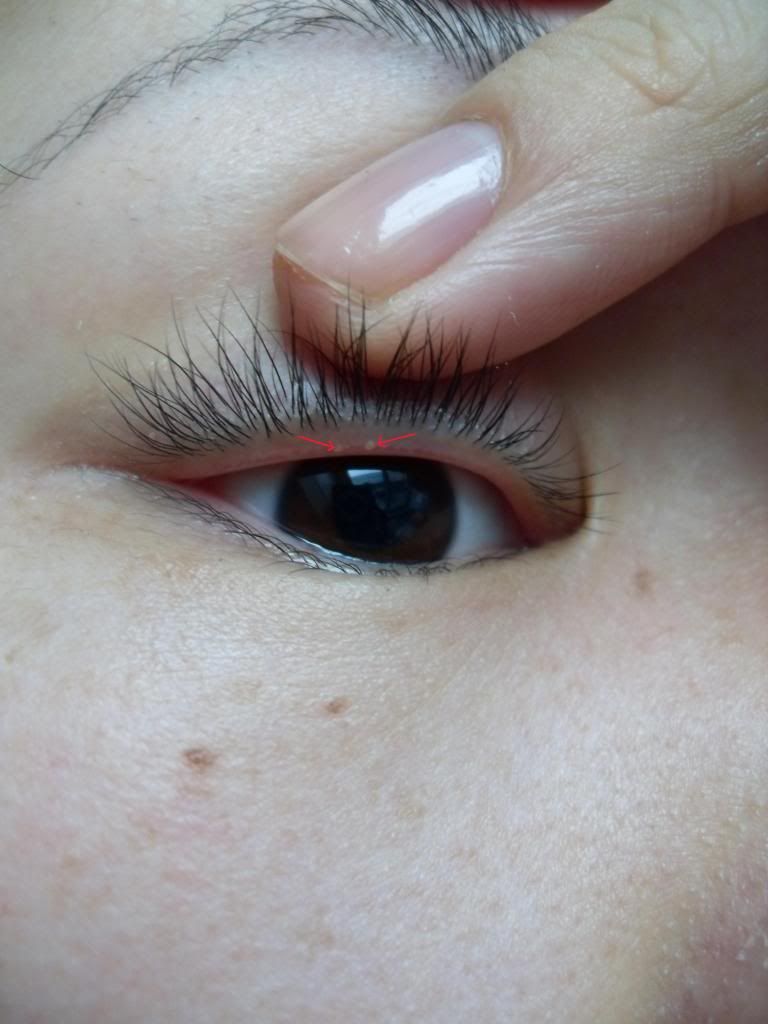 Bump on Eyelid Makeup images