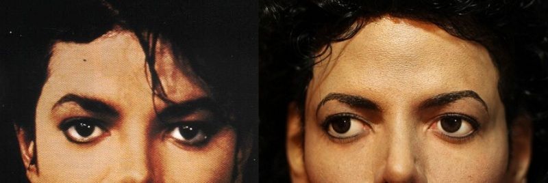 foreheadcompare2.jpg