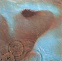 pink_floyd_meedle.jpg