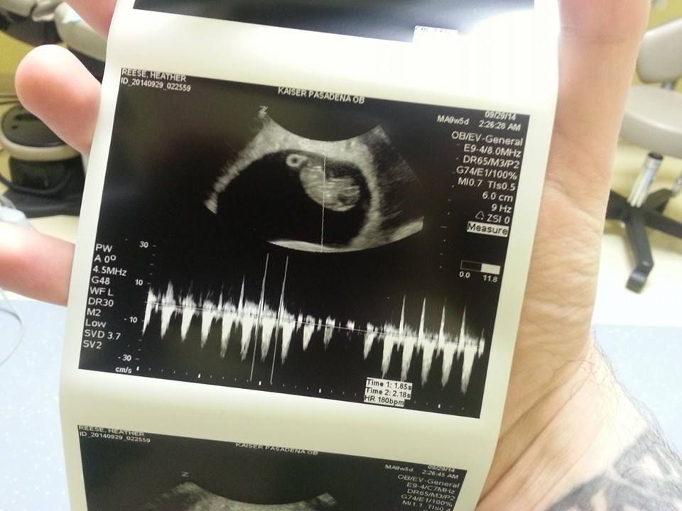 Ultrasound.jpg