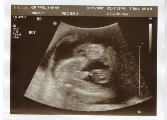 ultrasound images of girls and boys. Boys or Girls???? We had our ultrasound. (originally posted on myspace on 
