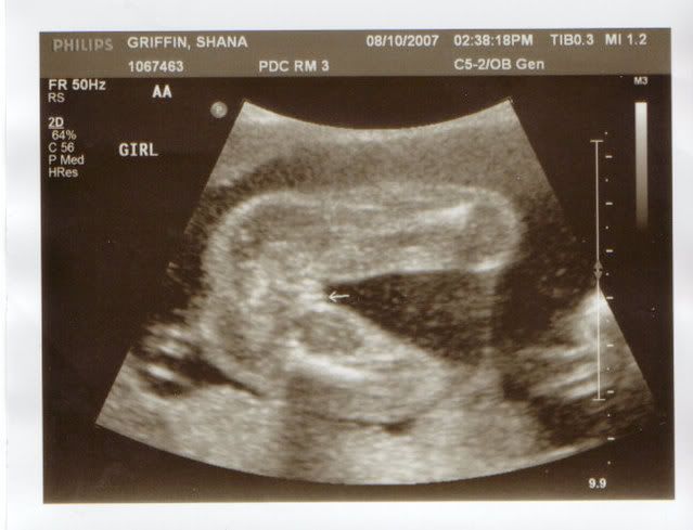 ultrasound images of girls and boys. Boys or Girls???? We had our ultrasound. (originally posted on myspace on 