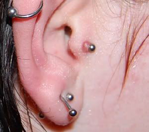 tragus infected bump labret double