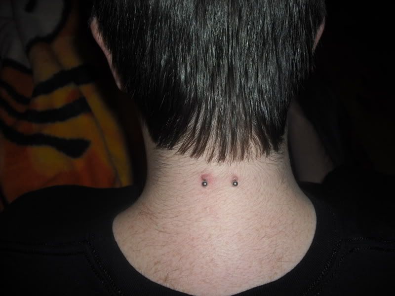 Hi guys, I have had my nape pierced for about 6 1/2 months but over the last 