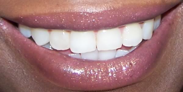 lips.jpg