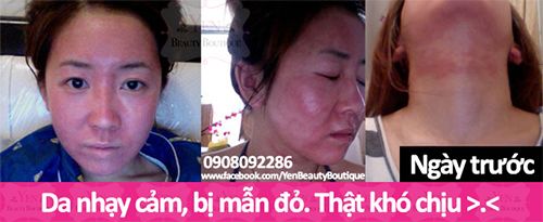 Yến Mạch 100% ORGANIC, Hạt Lanh, Quinoa, Mật ong, Dầu dừa, Dầu hạt nho và  Dầu Oliu❣ - 18