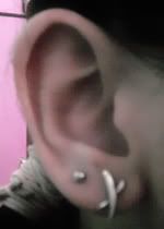 right ear