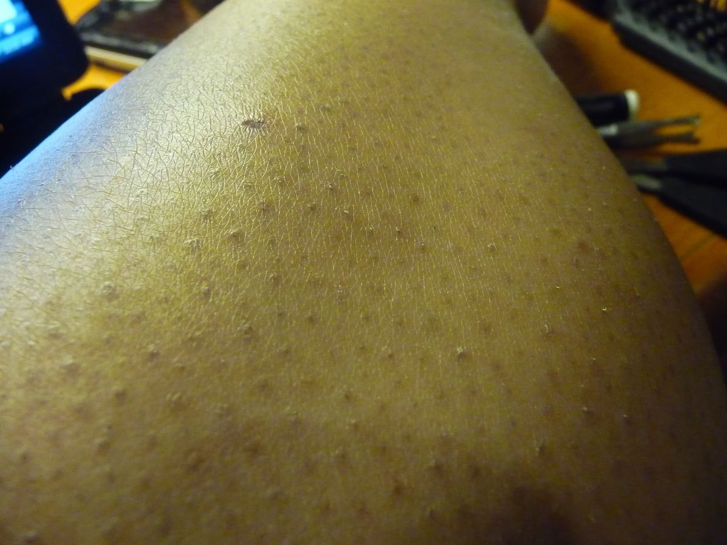 Dark Spots On Legs From Shaving legs look strange when shaving 