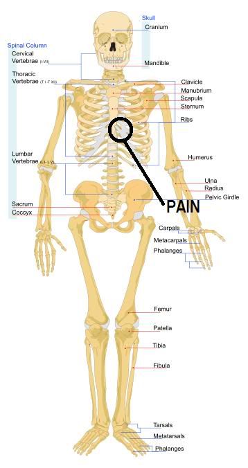 Chronic Pain Chronic Pain Under Left Rib