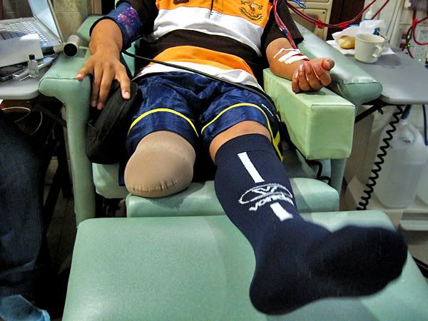 Diabetic patient with amputated right leg