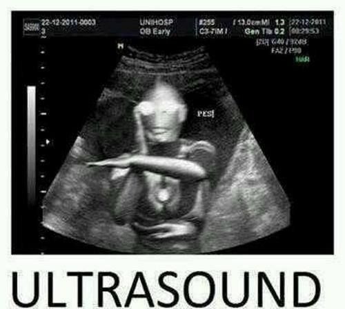 [Image: ultrasound.jpg]