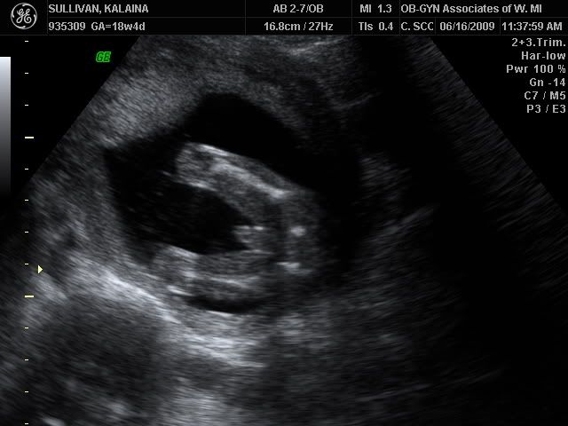 Boy Parts Ultrasound