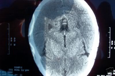 Here's the description found at ebay - A powerful image in a genuine CT scan of a young woman's brain.  A full lenth portrait of Jesus Christ appears on one of the images of this un-retouched CT scan.