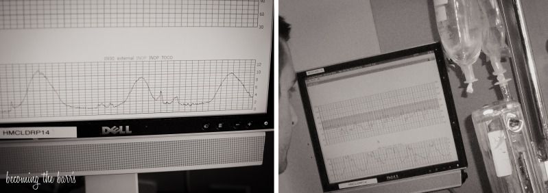 contractions monitor