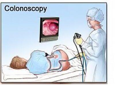 Colonoscopy on Colonoscopy   The    Blind Spot    In The Colon     A Healthy Colon