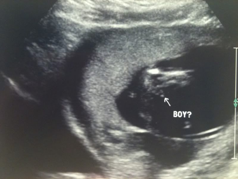 To tell pictures ultrasound boy or how girl Ultrasound Signs