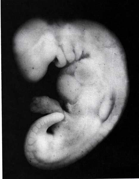 embryoweek4.jpg