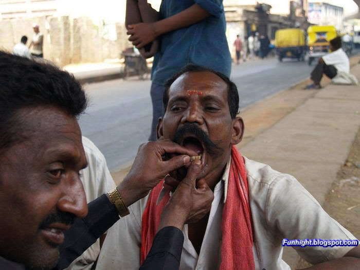 street dentist india