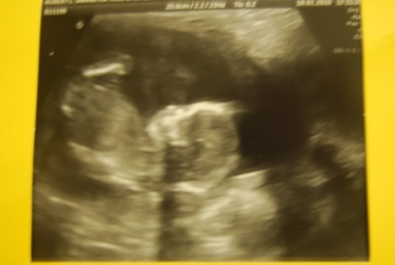 baby3.jpg