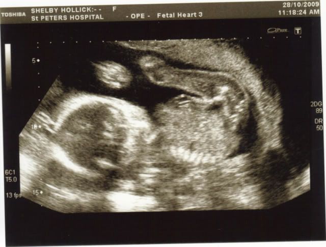 Scan1215.jpg