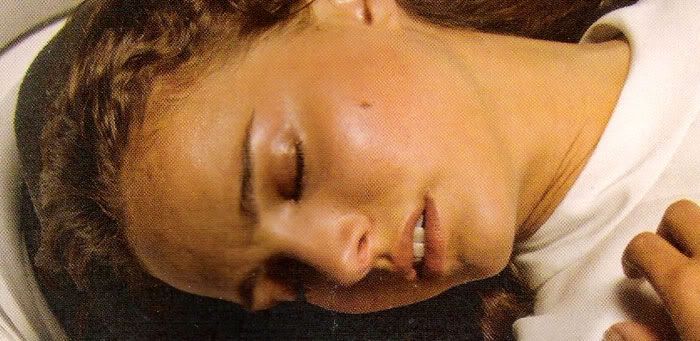 Padme dies after giving birth to Luke and Leia on the asteroid Polis Massa in REVENGE OF THE SITH.