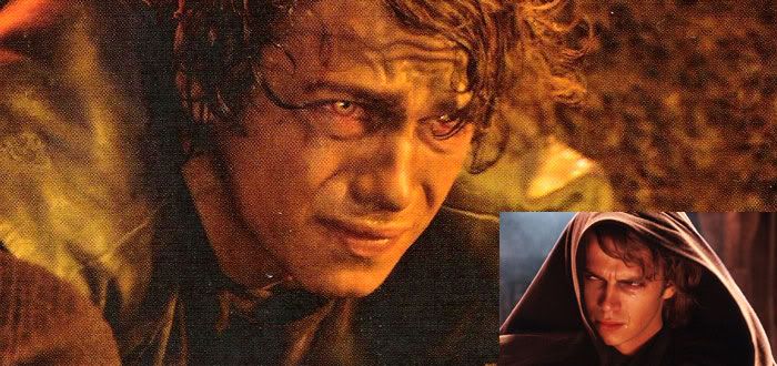 Anakin moments before he fries.