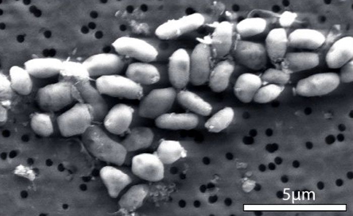An image of the GFAJ-1 bacteria grown on arsenic.