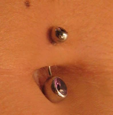 migrated navel piercing. Navel Piercing Forum Forum