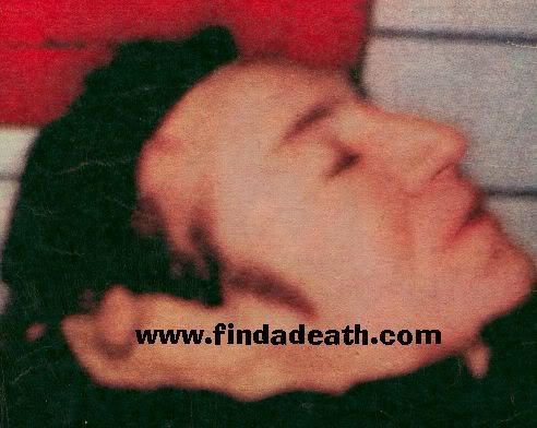 John+lennon+dead+body+pic